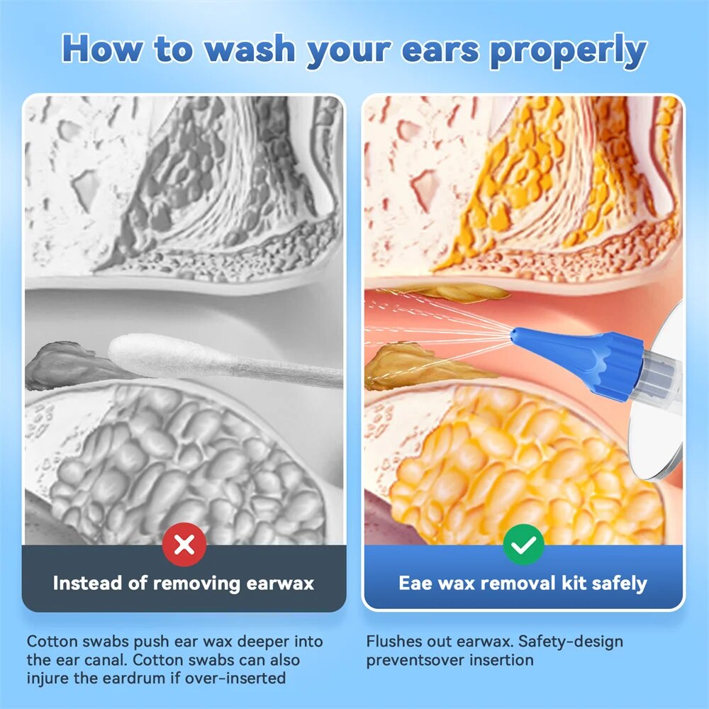 EAR WAX Removal คู่มือทําความส - Waxing Kit Home บทวิจารณ์และราคา