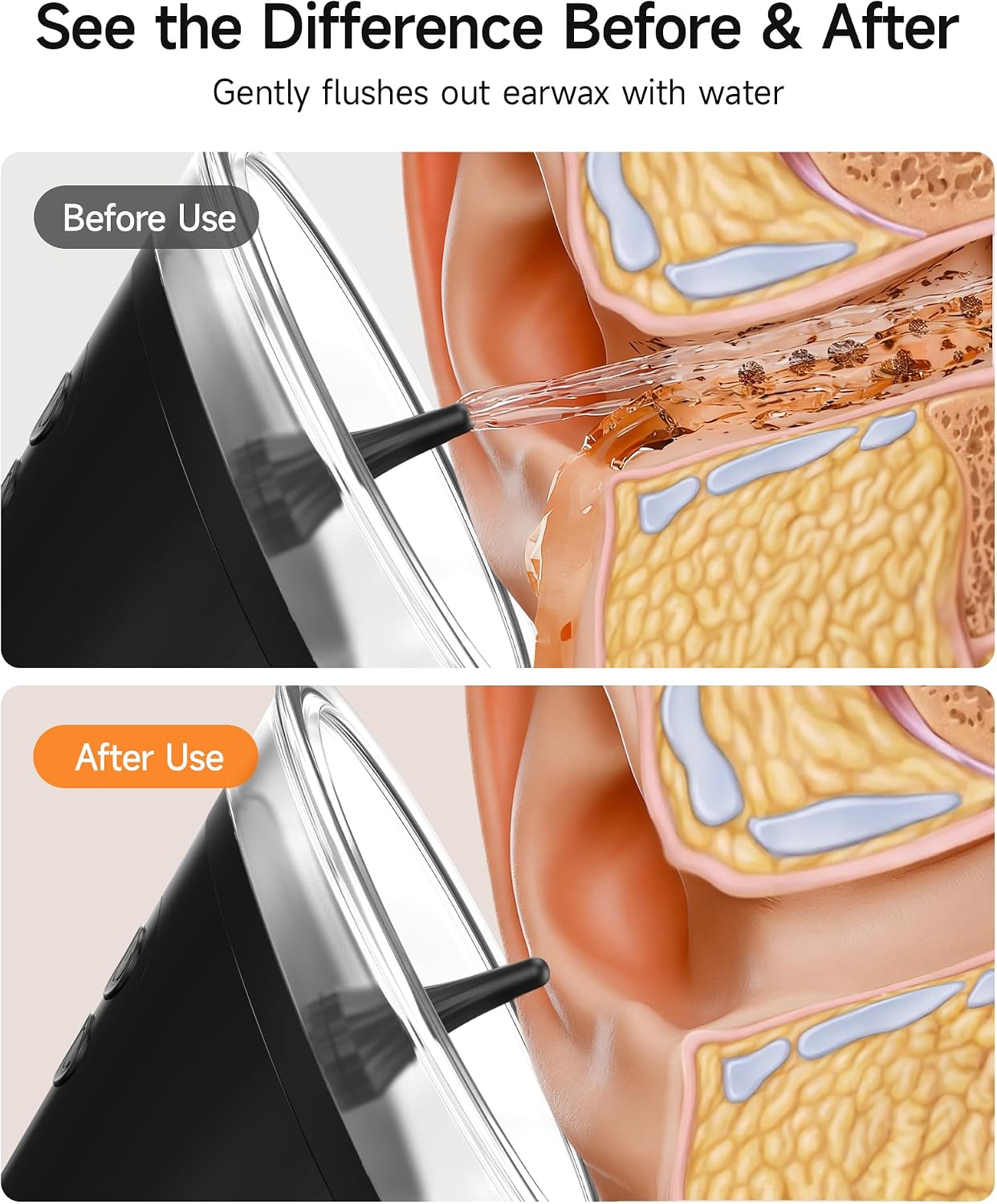 ชุดอุปกรณ์ทำความสะอาดหู, ระบบล - Waxing Kit Home บทวิจารณ์และราคา